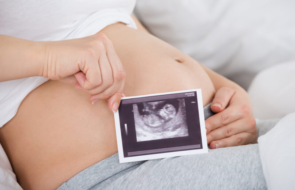 Pregnant Woman With Ultrasound Photo